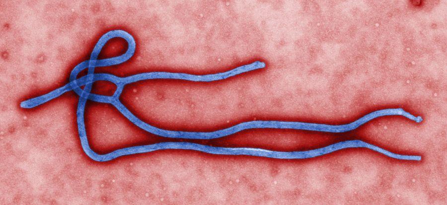 A transmission electron micrograph of the Ebola Virus 