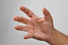 Most people in the world are right-handed. Handedness is determine through the left and right halves of the brain. 